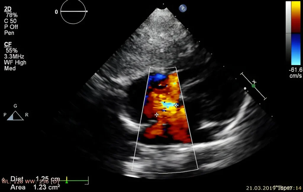 3d-power-doppler-angiography-obstetrics-(OBS)-doppler-in-kharghar-advanced-diagnostic-centre-best-diagnostic-centre-henotic-diagnostics-kharghar-navi-mumbai