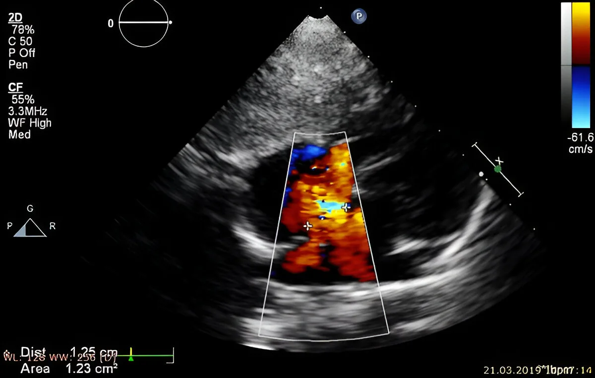 Detailed Anomaly Scan or Level 2 Scan