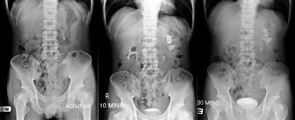 CT-scan-in-navi-mumbai-ct-ivu-ivp-henotic-diagnostics-kharghar-navi-mumbai CT-scan-in-navi-mumbai-ct-ivu-ivp-henotic-diagnostics-kharghar-navi-mumbai