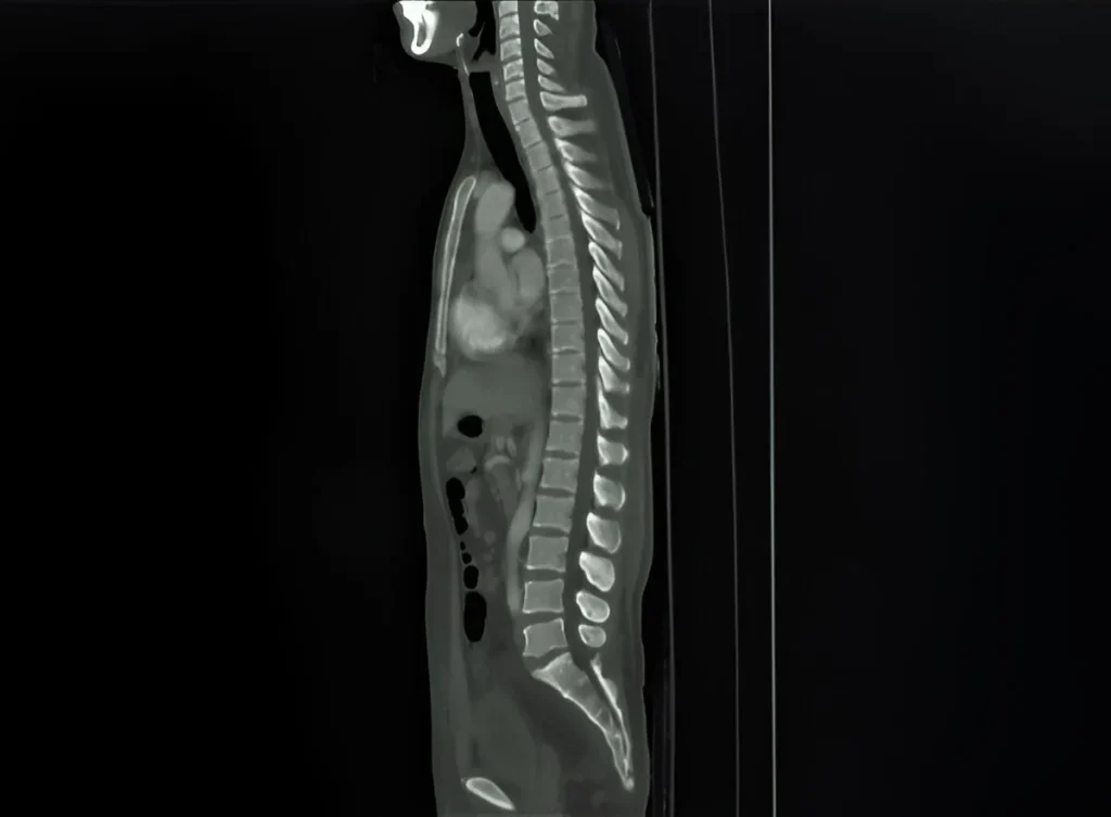 CT-scan-in-navi-mumbai-ct-myelography-henotic-diagnostics-kharghar-navi-mumbai CT-scan-in-navi-mumbai-ct-myelography-henotic-diagnostics-kharghar-navi-mumbai