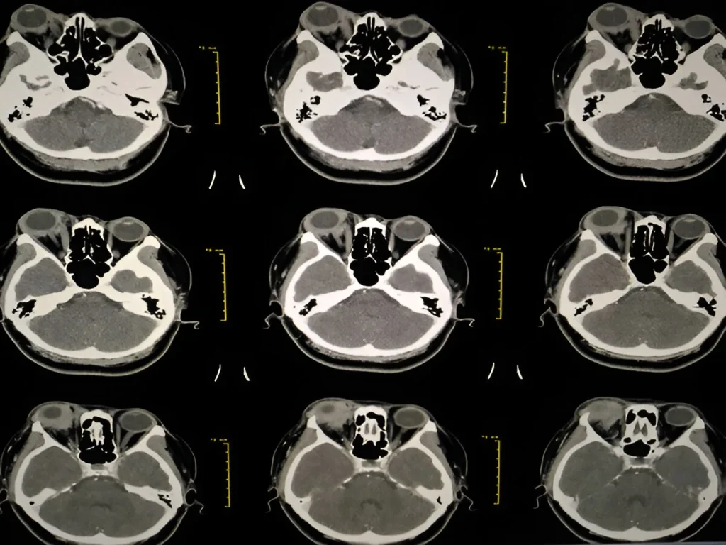 CT-scan-in-navi-mumbai-ct-orbit-henotic-diagnostics-kharghar-navi-mumbai CT-scan-in-navi-mumbai-ct-orbit-henotic-diagnostics-kharghar-navi-mumbai
