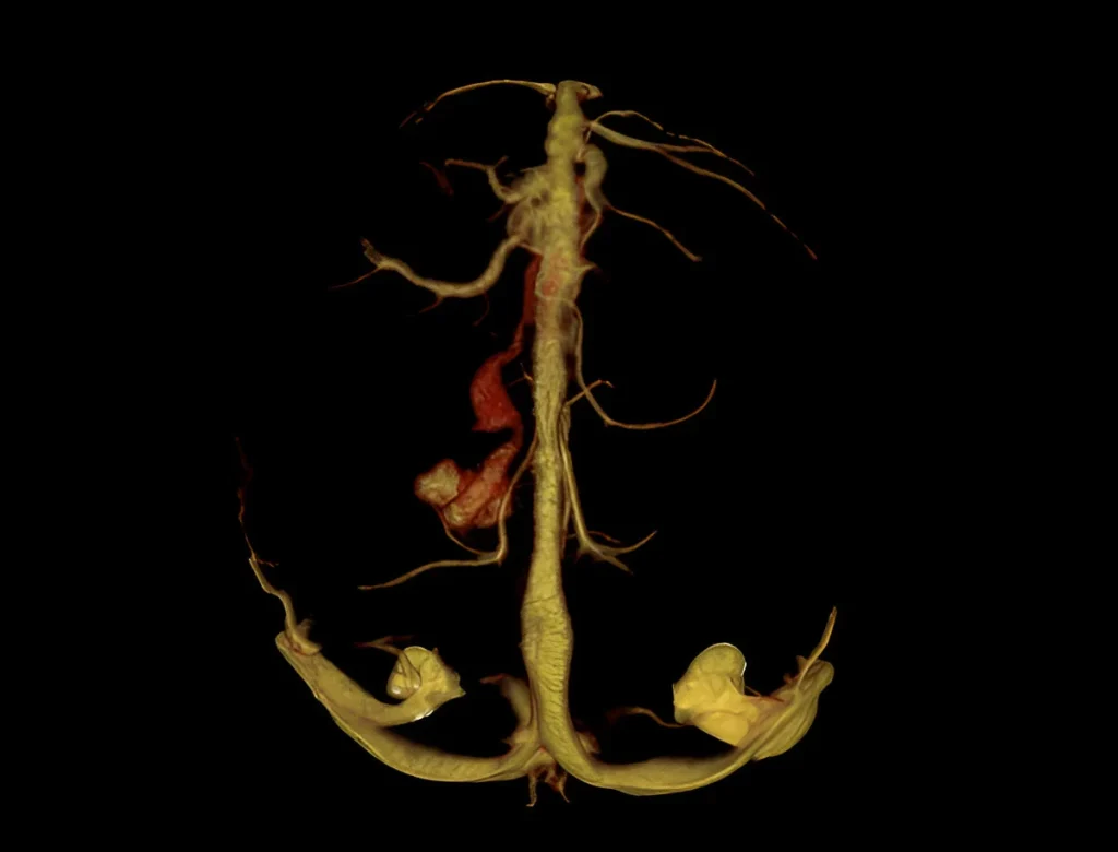 CT-scan-in-navi-mumbai-ct-venography-henotic-diagnostics-kharghar-navi-mumbai CT-scan-in-navi-mumbai-ct-venography-henotic-diagnostics-kharghar-navi-mumbai