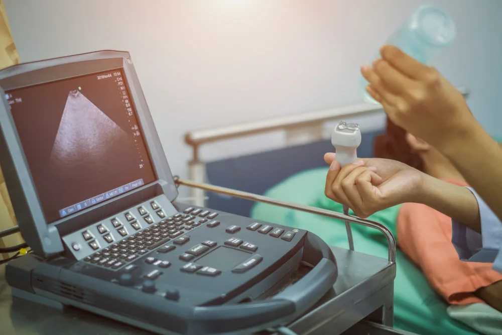 Samsung UGEO WS80A 4D Ultrasound Machine for Fetal Screening